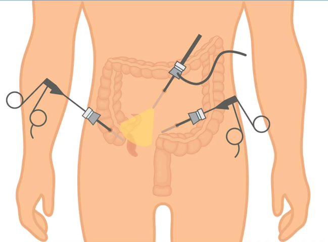 Appendix