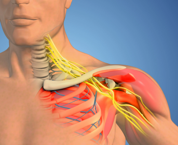 Cervical Rib