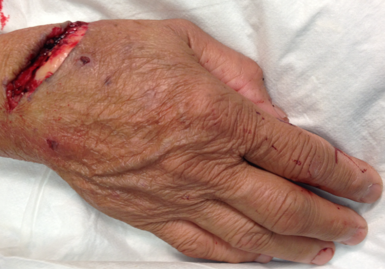 Vascular Trauma